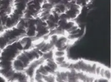 Butiran Darah Sebelum Minum NSTM